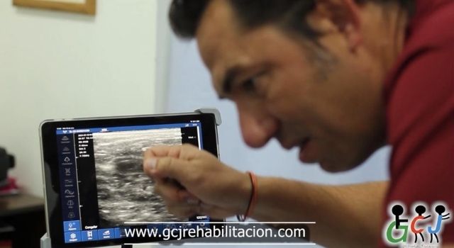 fisioterapia en san juan del río